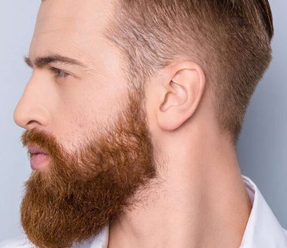 greffe-de-barbe-a-bruxelles greffe de barbe à Bruxelles