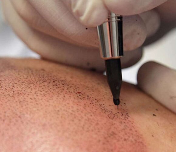 micropigmentation-a-bruxelles Micropigmentation à Bruxelles